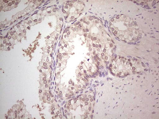 Hairless / HR Antibody (aa946-1189, clone OTI1D9, Carrier-free)