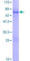Human OTX1 Protein (Recombinant GST)