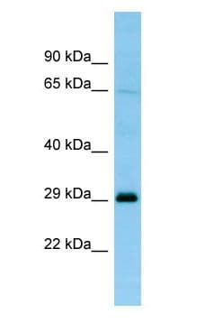 NQO2 Antibody (C-Terminus)