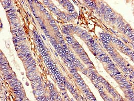 Polyclonal Rabbit anti-Human EEA1 Antibody (IHC, IF, WB)