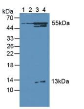 OXCT1 Antibody (aa40-489)