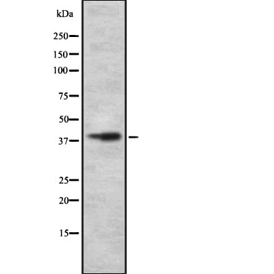 SLC30A8 / ZNT8 Antibody
