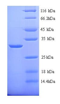 Rat CA1 / Carbonic Anhydrase I Protein (Recombinant His)
