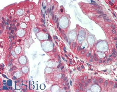 FURIN Antibody (aa105-221)