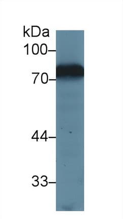 TF / Transferrin Antibody (aa22-176)