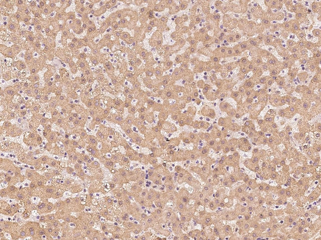 Polyclonal Rabbit anti-Human PSMA2 Antibody (IHC, WB)