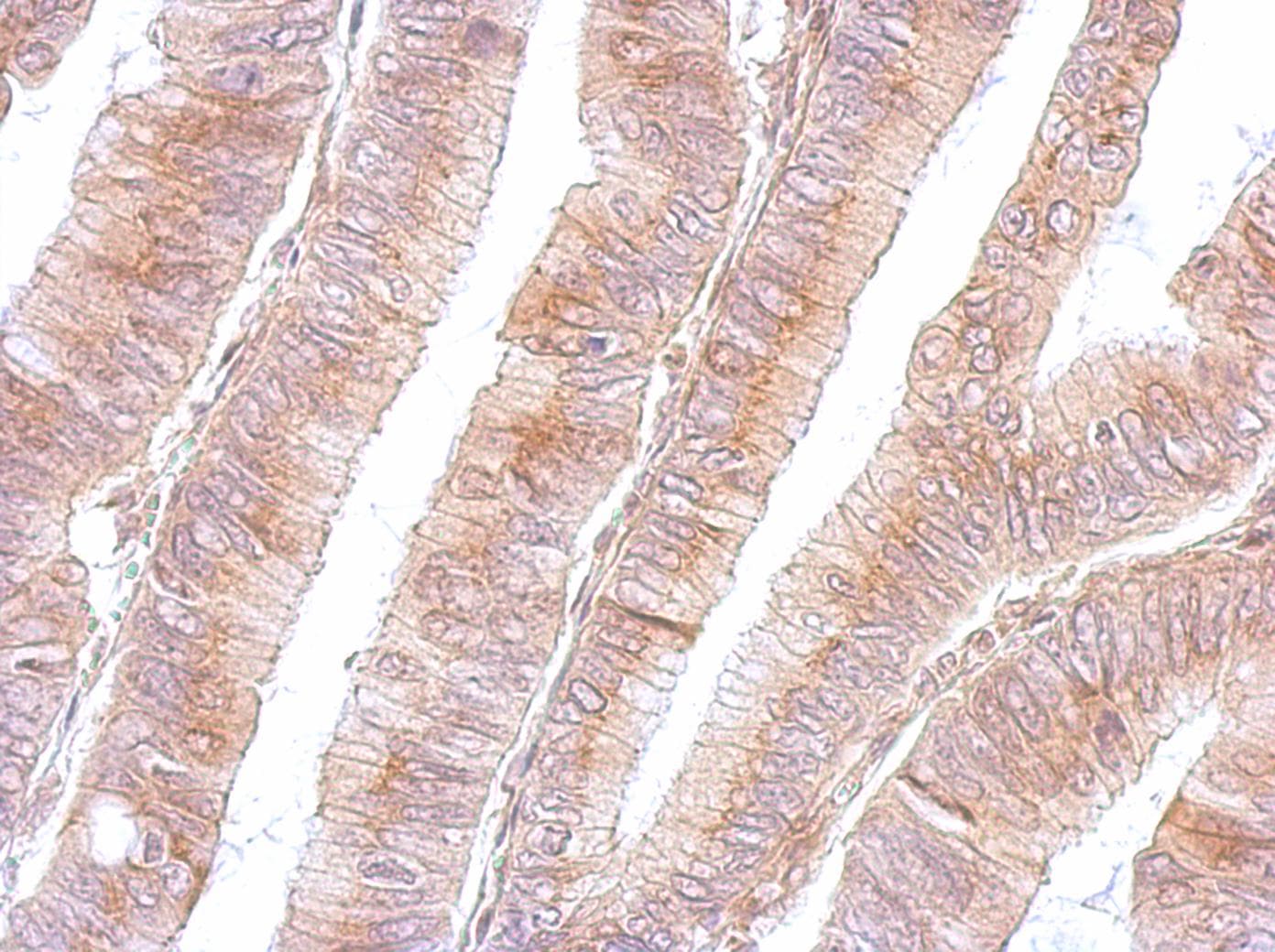 Polyclonal Rabbit anti-Human B3GNT3 / TMEM3 Antibody (aa122-338, IHC, WB)
