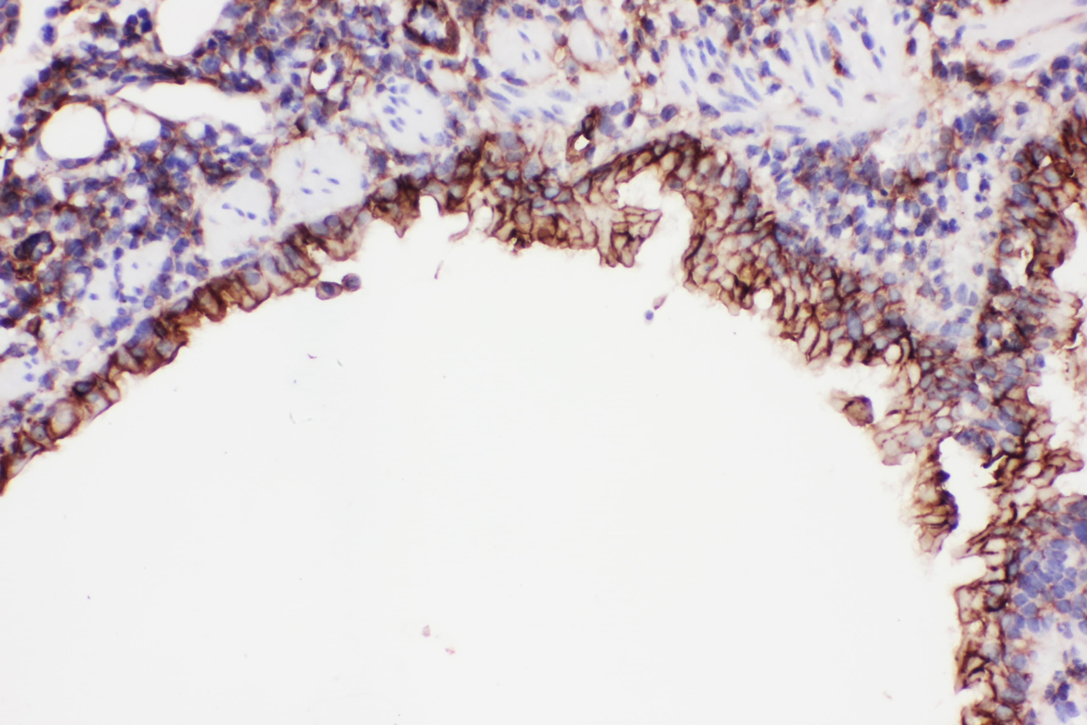 ICAM-1 / CD54 Antibody (aa198-537)