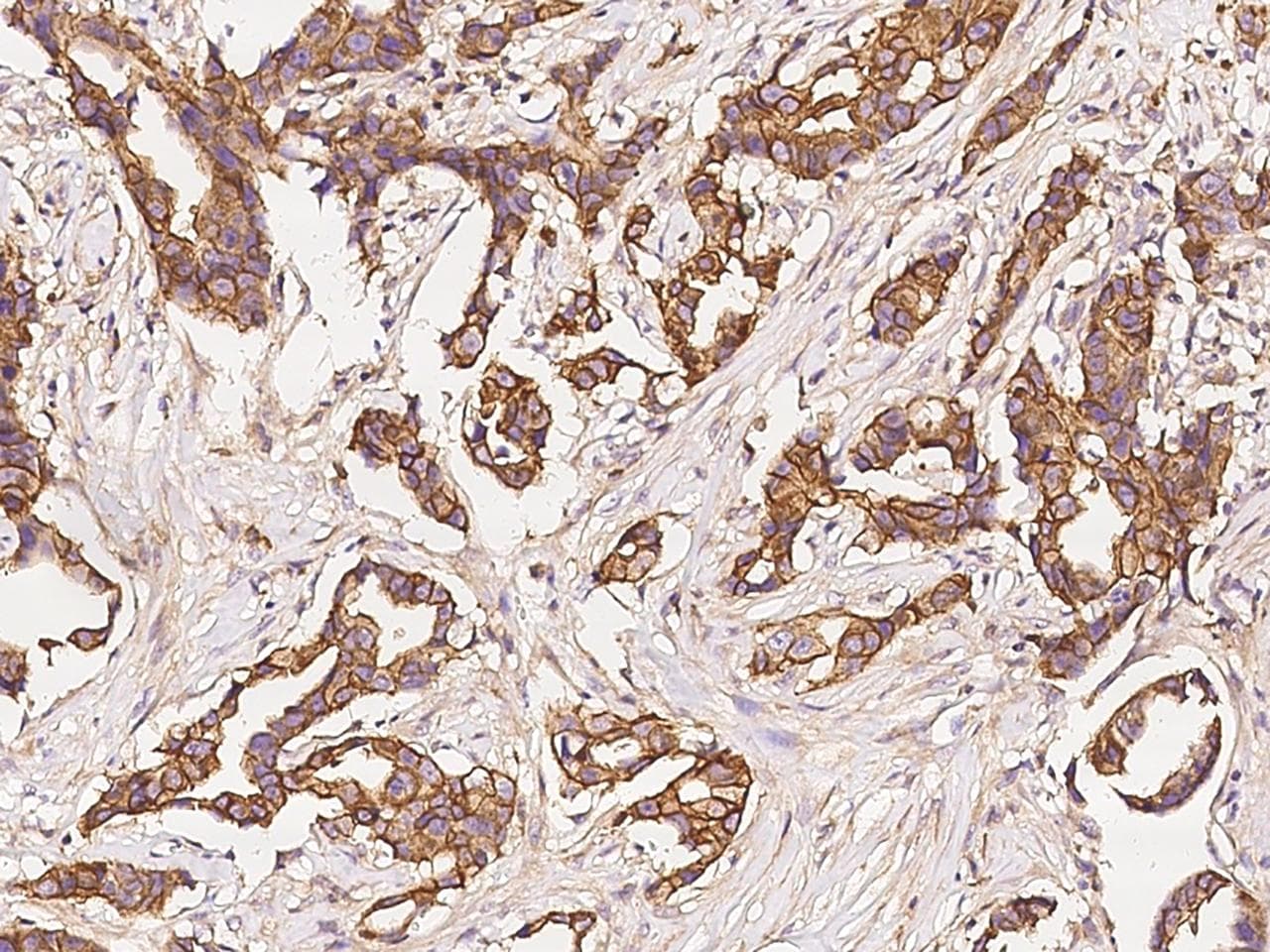 Polyclonal Rabbit anti-Human GAP43 Antibody (Preservative Free, IHC, WB)