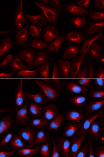 TLE1 / TLE 1 Antibody