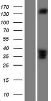 RASGRF2 / RAS-GRF2 Protein (Over-Expression Lysate Myc-DDK (Flag))