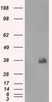 CD32A Antibody (clone OTI9G5)