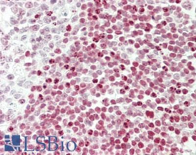 IHC-plus™ Polyclonal Rabbit anti-Human FBL / FIB / Fibrillarin Antibody (aa271-321, IHC, WB)
