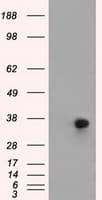 Monoclonal Mouse anti-Human ERCC1 Antibody (clone OTI2E11, IHC, IF, WB)