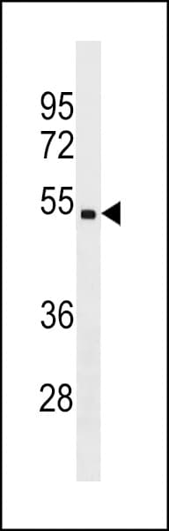 Polyclonal Rabbit anti-Human CHST5 Antibody (aa275-302, WB)