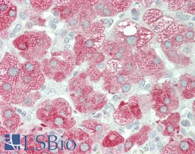 IHC-plus™ Polyclonal Rabbit anti-Human CYP17 / CYP17A1 Antibody (aa358-388, IHC, IF, WB)