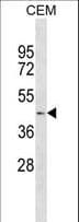 Angiotensin I/II/III Antibody (aa37-65)
