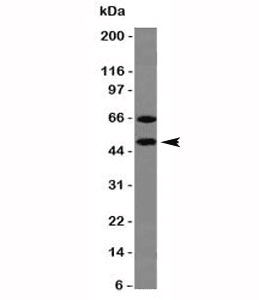 CHGA / Chromogranin A Antibody (clone CHGA/777, Ready-to-Use)