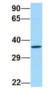 FP / PTGFR Antibody (aa199-248)
