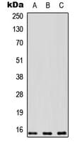Polyclonal Rabbit anti-Human PEA15 / PEA-15 Antibody (C-Terminus, IHC, IF, WB)