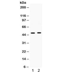 Polyclonal Rabbit anti-Human SFRP4 Antibody (IHC, WB)
