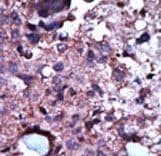 Polyclonal Rabbit anti-Human PKLR Antibody (aa1-30, IHC, WB)