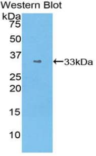 STAT1 Antibody (aa343-602)