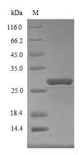 Mouse SOCS1 Protein (Recombinant 10His, N-terminus + Myc, C-terminus)