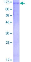 Human BUB1 Protein (Recombinant GST)