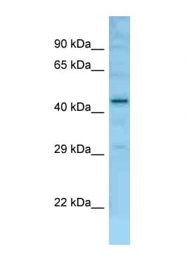 Polyclonal Rabbit anti-Mouse FAM170B Antibody (aa251-300, WB)