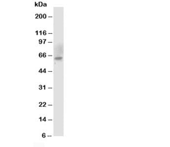 CHEK2 / CHK2 Antibody (aa427-441)