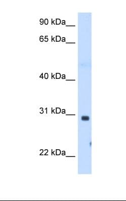 ST3GAL3 / ST3N Antibody (C-Terminus)