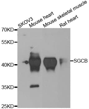 SGCB / SGC / Sarcoglycan Beta Antibody