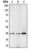 Polyclonal Rabbit anti-Human Complement C1R Antibody (Internal, WB)