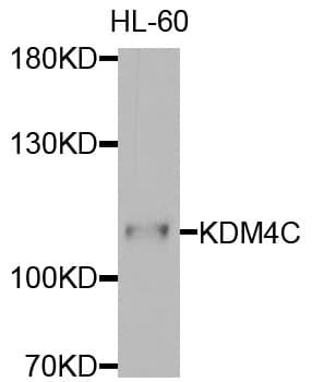 Polyclonal Rabbit anti-Human KDM4C / JMJD2C Antibody (aa350-570, WB)