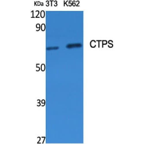 Polyclonal Rabbit anti-Human CTPS Antibody (N-Terminal, IHC, WB)