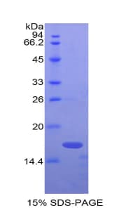 Human Beta-N-Acetylglucosaminidase Protein (Recombinant His)