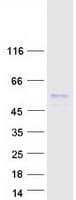 Human SR Protein / RNPS1 (Recombinant Myc-DDK (Flag))