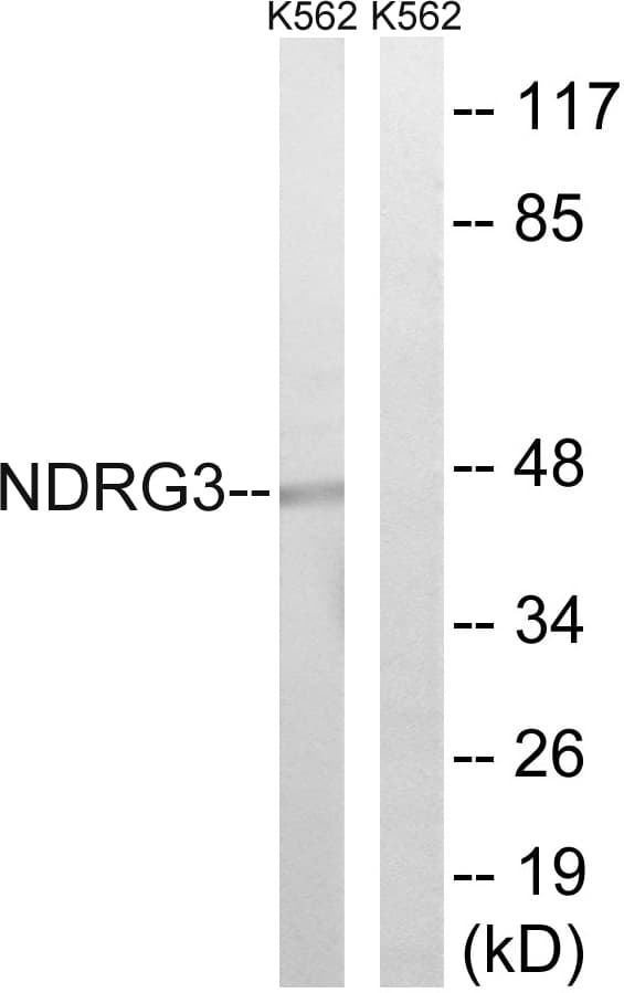 Polyclonal Rabbit anti-Human NDRG3 Antibody (aa206-255, IHC, WB)