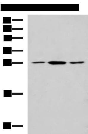 CLTB Antibody