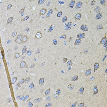 CDH16 / Cadherin 16 Antibody