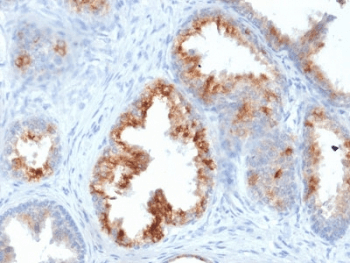 AMACR / P504S Antibody (clone AMACR/1864, Ready-to-Use)