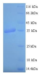 Epstein-Barr Virus LMP1 Protein (Recombinant His)