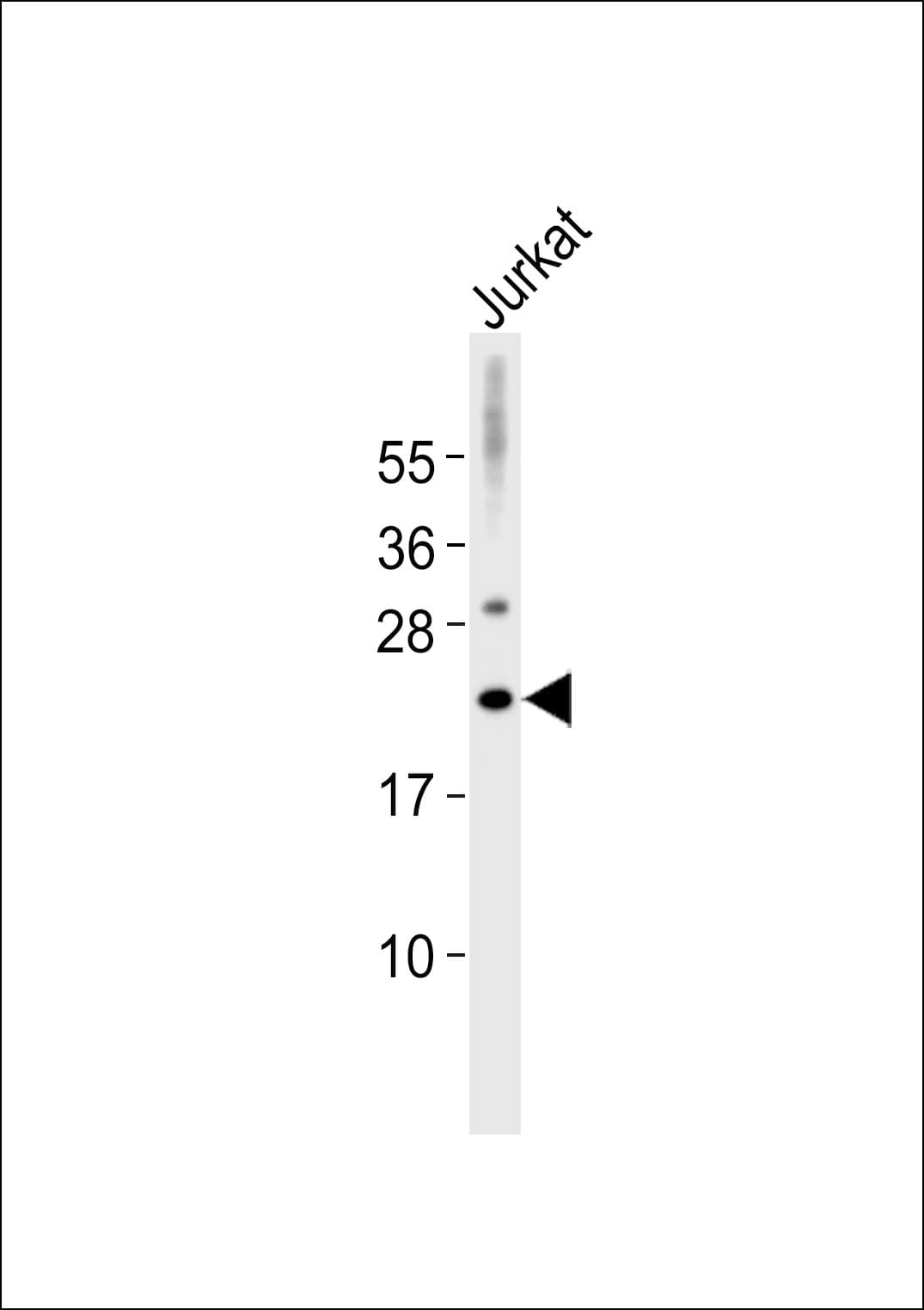 MRPL32 Antibody