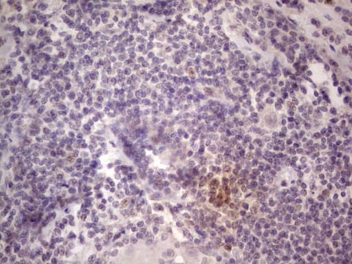 TCF12 / HEB Antibody (aa1-250, clone OTI4D6)