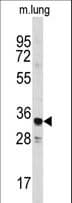 Polyclonal Rabbit anti-Human ANXA3 / Annexin A3 Antibody (aa146-178, WB)