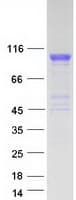 Human ACE / CD143 Protein (Recombinant Myc-DDK (Flag))