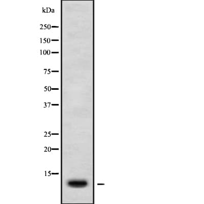 Polyclonal Rabbit anti-Human CXCL11 Antibody (IHC, WB)