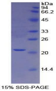 Human PROS1 / Protein S (Recombinant His)