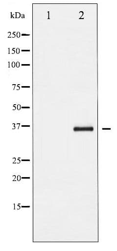 NFKBIB / IKB Beta / IKBB Antibody (phospho-Ser23)